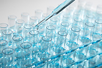 cromatografo hplc polifenoles